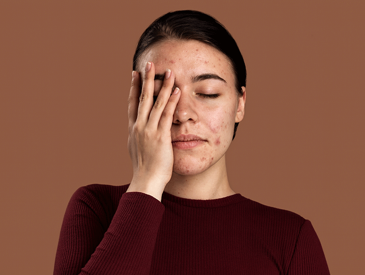 کرم ضدجوش ایرانی