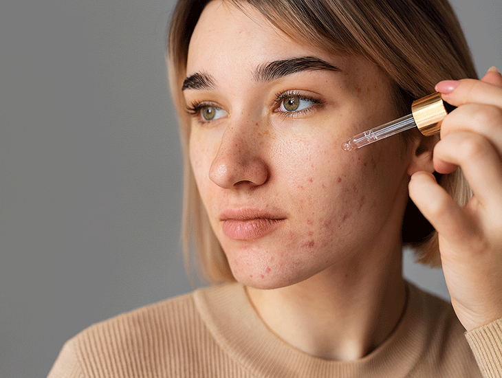 بهترین کرم ضدجوش