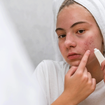 کنترل چربی پوست