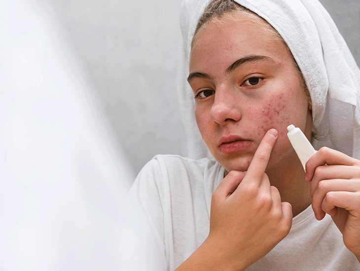 کنترل چربی پوست