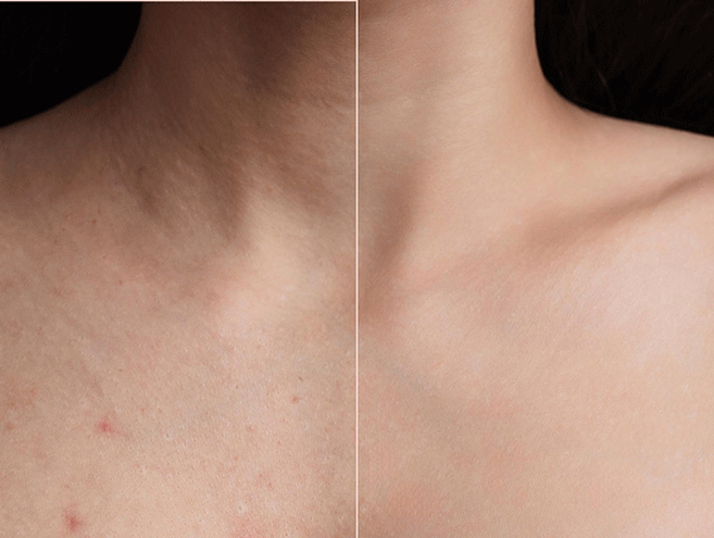 تاثیر اسپری ضدجوش