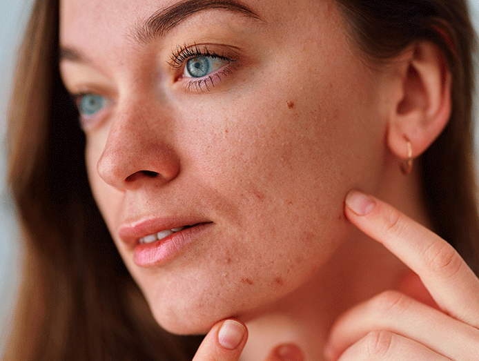 بهترین کرم کنترل کننده چربی پوست