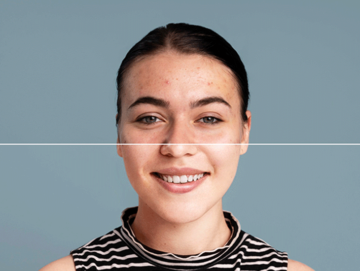 سرم مناسب پوست