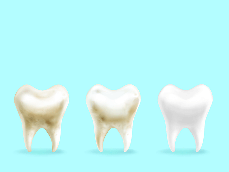 محافظ کامپوزیت