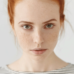 بهترین روش درمان لکه‌های تیره پوست؛ معرفی مؤثرترین سرم و روتین ضدلک