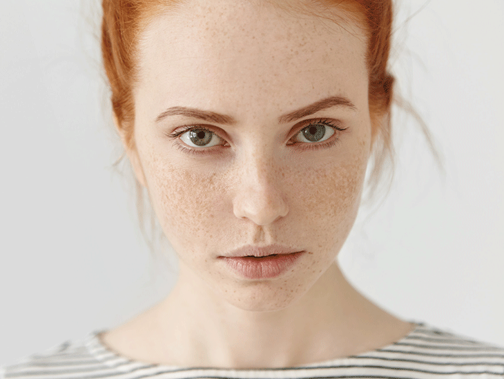 بهترین روش درمان لکههای تیره پوست؛ معرفی مؤثرترین سرم و روتین ضدلک