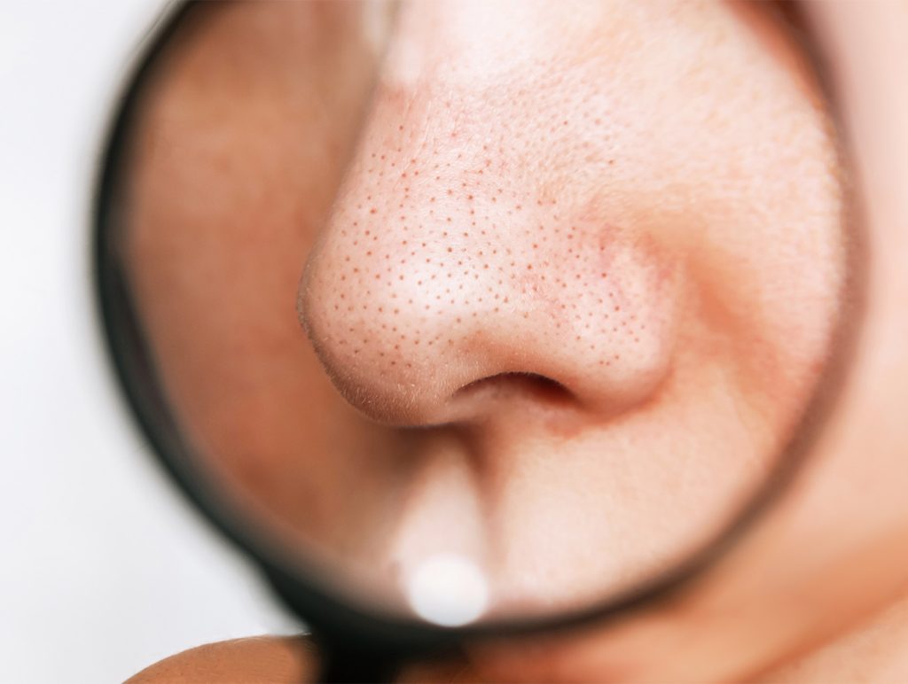 کوچک کردن منافذ پوست