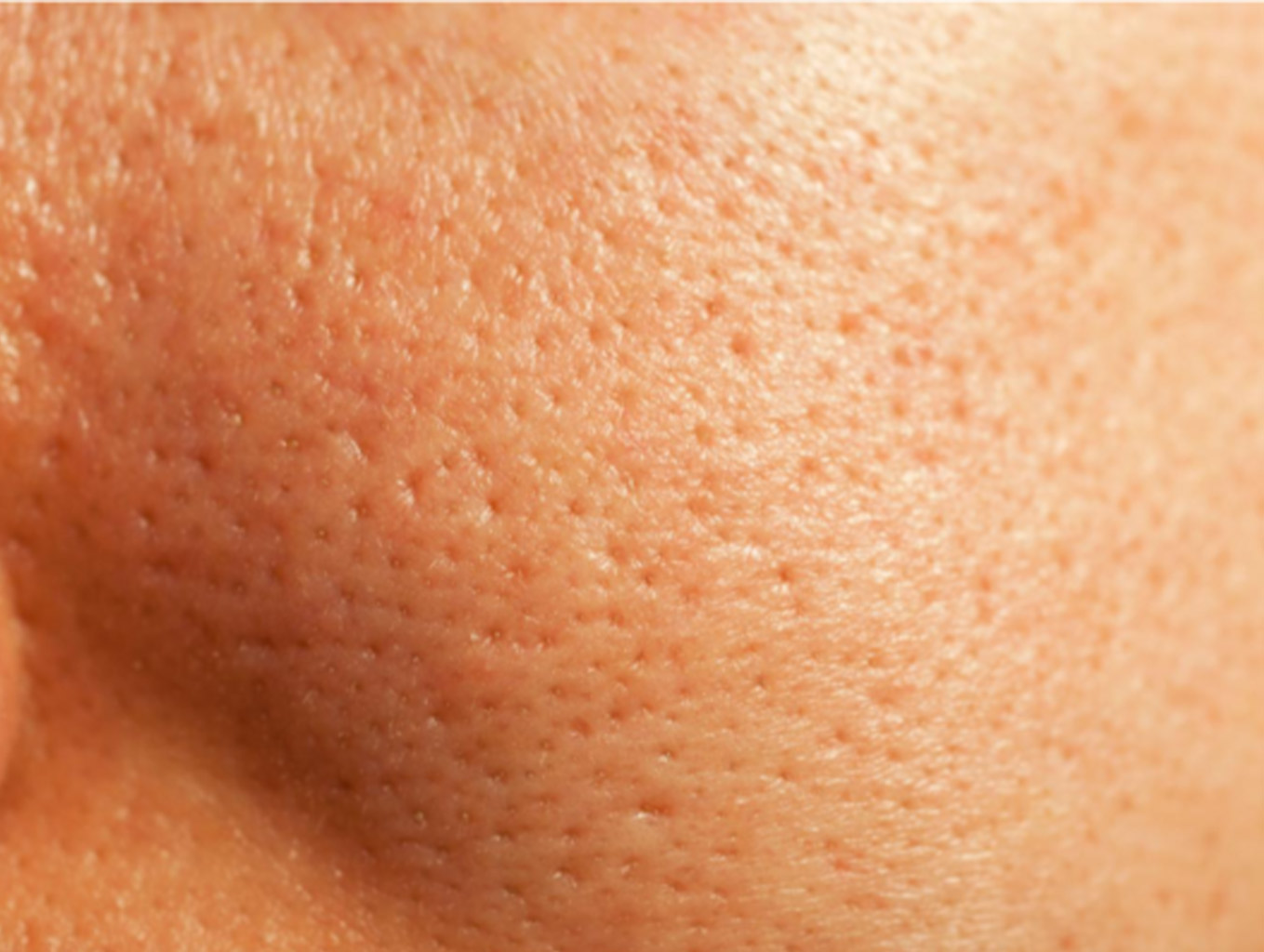 منافذ باز پوست