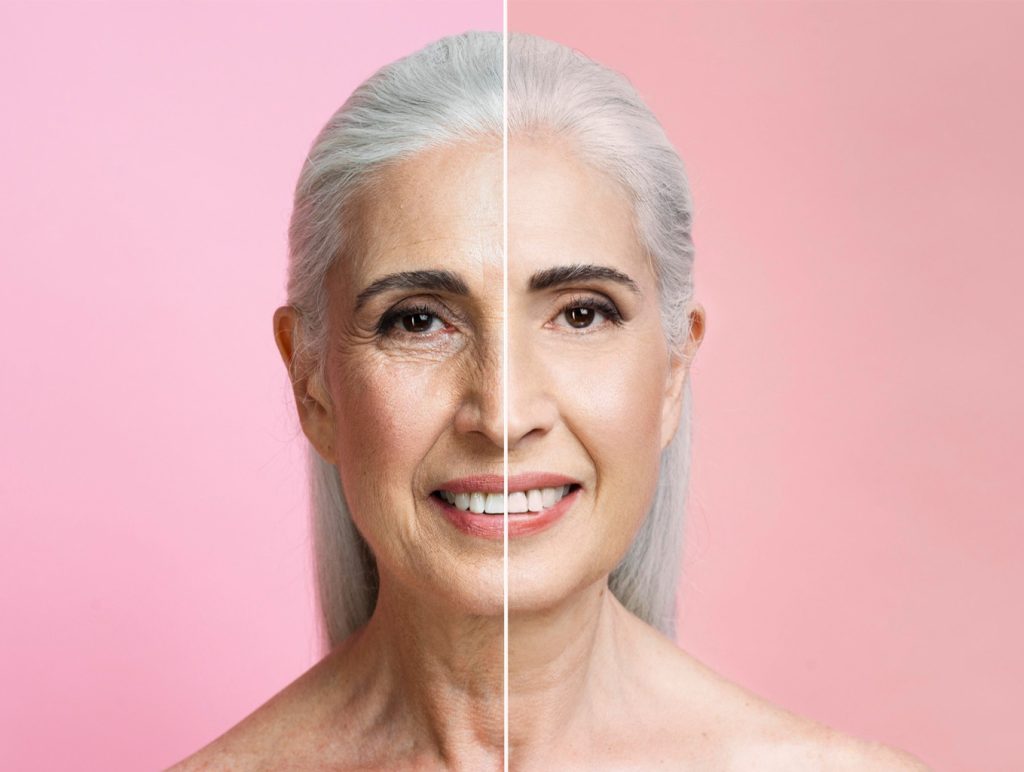 مقایسه قبل و بعد جوانسازی پوست صورت؛ کاهش چروک، افزایش شفافیت و سفتی پوست